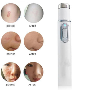 Blue Light Therapy Pore Acne Scar Remover Pen